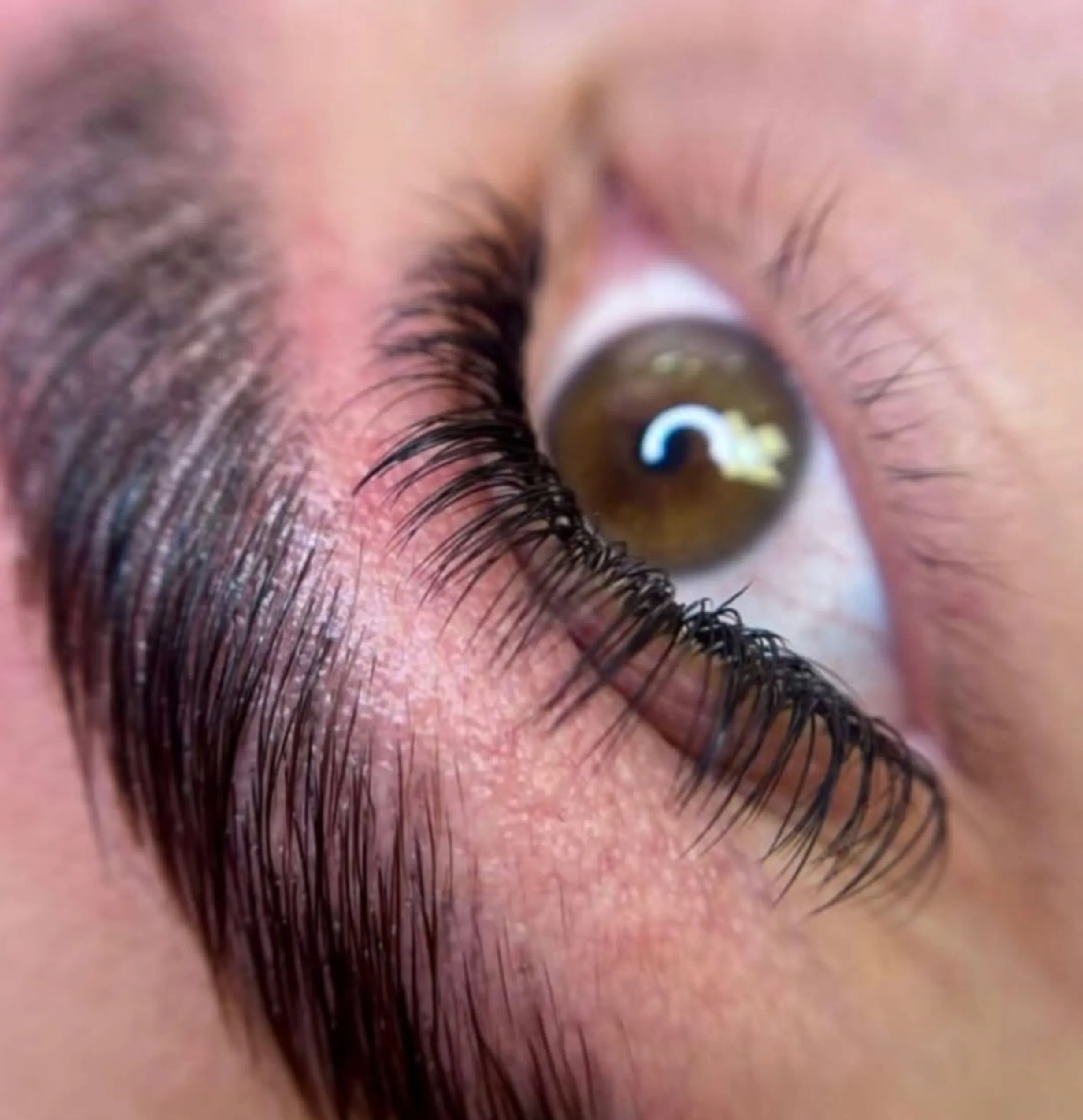 skin penetration procedures