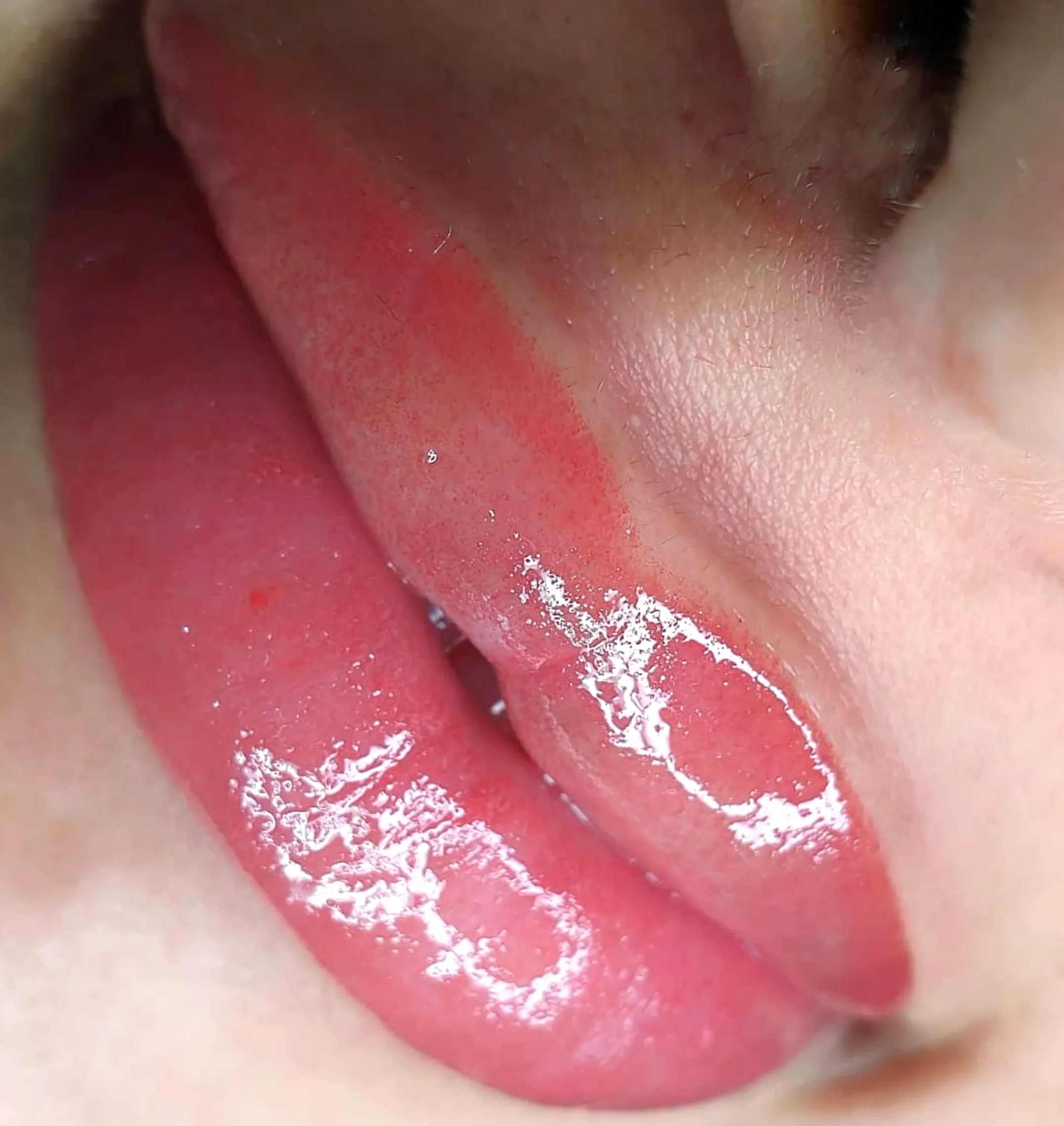 Prevent Cold Sores Lip Blush