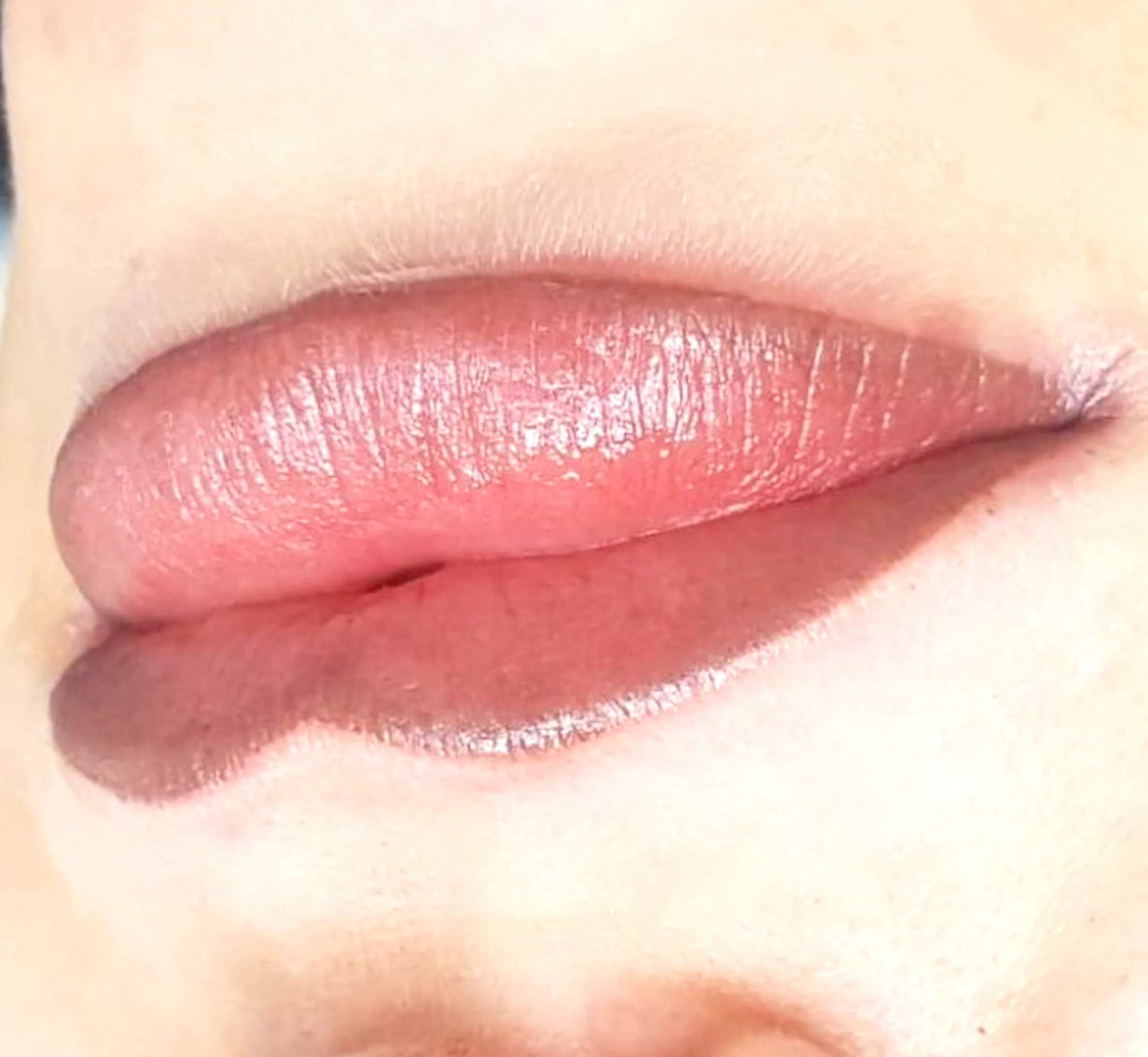lip tattoo cold sore risk