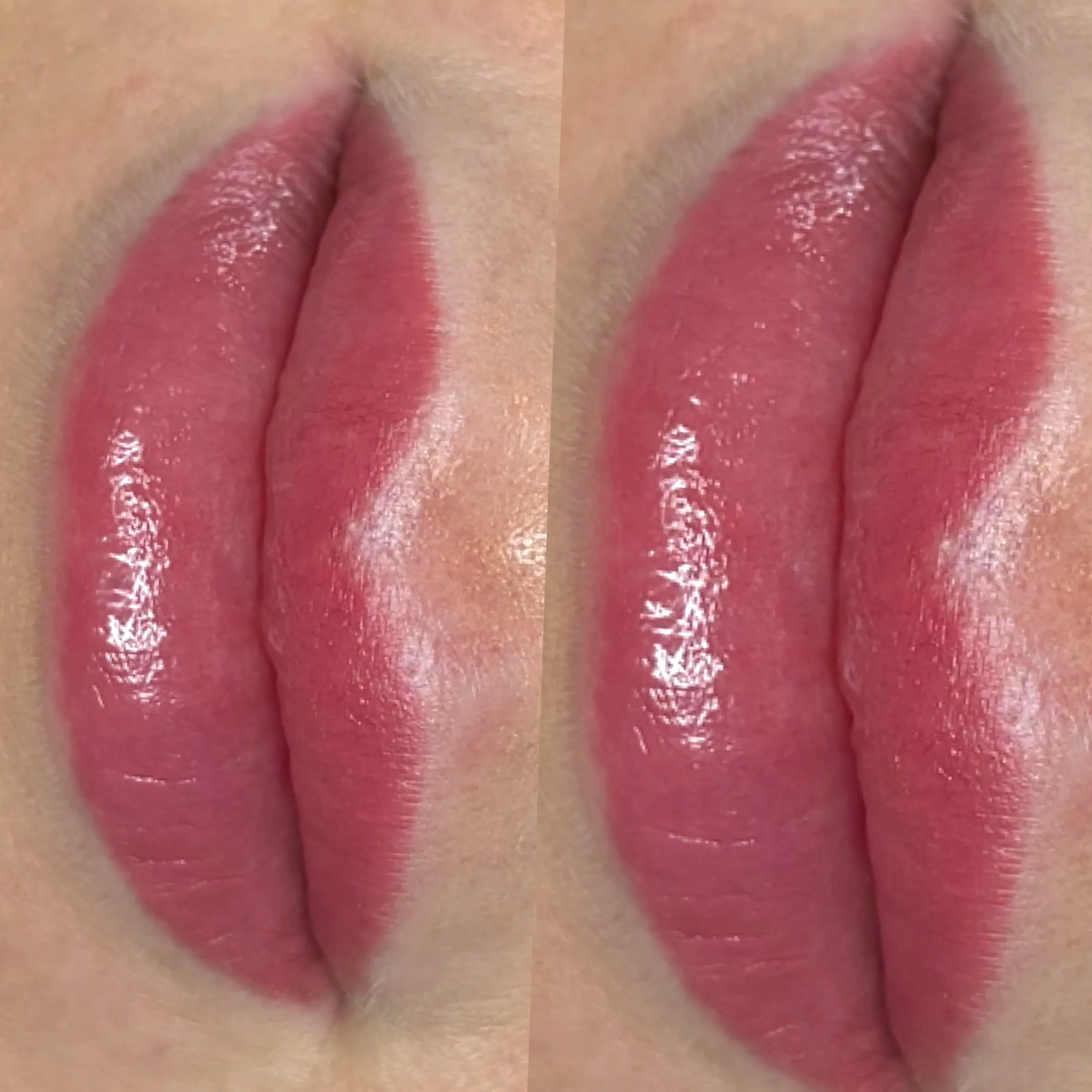 lip tattoo prep cold sore